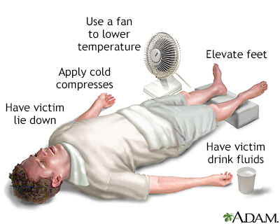 Treatment for Heat-Related Emergencies: - Understanding Heat-Related Emergencies