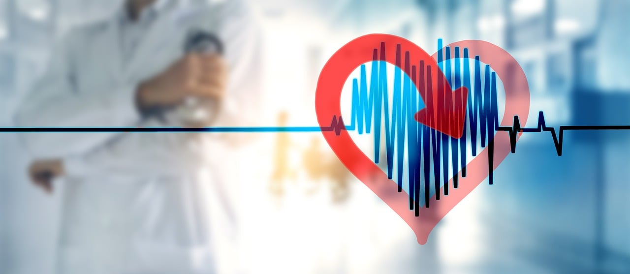 Irregular Heartbeat - Recognizing the Signs of a Heart Attack