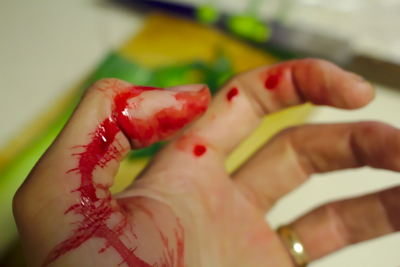 Handling Severe Bleeding and Wound Care