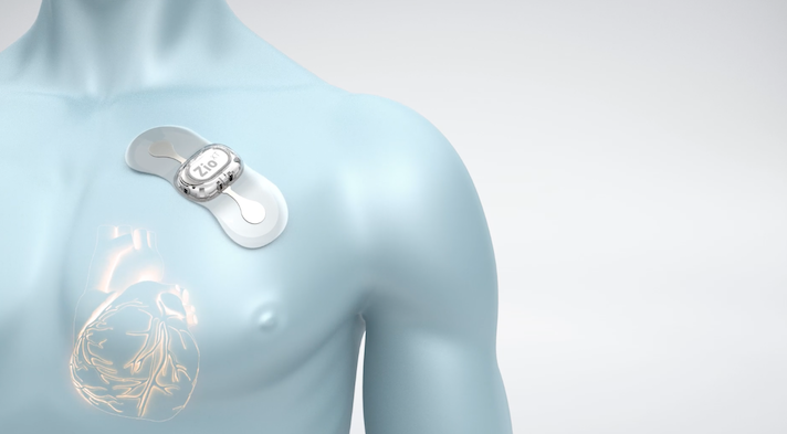 Wearable ECG Monitors - Biotech Gadgets: Merging Technology and Healthcare